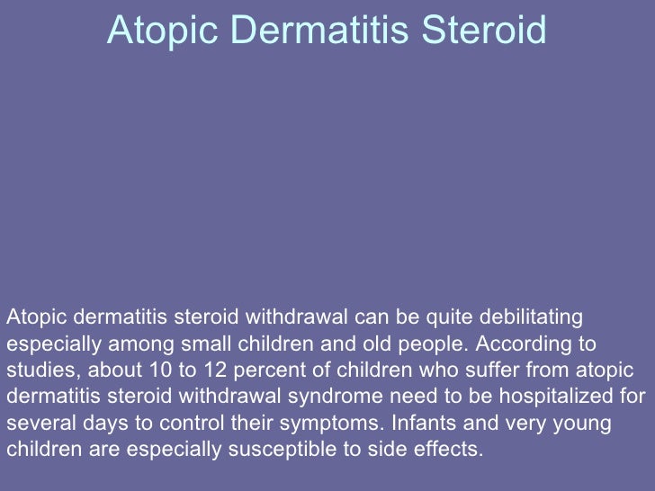 Atopic Dermatitis Steroid Withdrawal Dealing With Side Effects