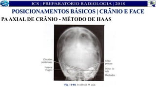 PAAXIAL DE CRÂNIO - MÉTODO DE HAAS
POSICIONAMENTOS BÁSICOS | CRÂNIO E FACE
 