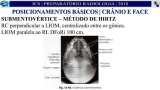 SUBMENTOVÉRTICE – MÉTODO DE HIRTZ
RC perpendicular a LIOM, centralizado entre os gônios.
LIOM paralela ao RI. DFoRi 100 cm.
POSICIONAMENTOS BÁSICOS | CRÂNIO E FACE
 