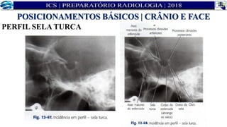 PERFIL SELA TURCA
POSICIONAMENTOS BÁSICOS | CRÂNIO E FACE
 