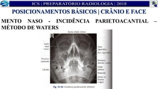 MENTO NASO - INCIDÊNCIA PARIETOACANTIAL –
MÉTODO DE WATERS
POSICIONAMENTOS BÁSICOS | CRÂNIO E FACE
 