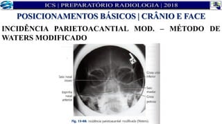 INCIDÊNCIA PARIETOACANTIAL MOD. – MÉTODO DE
WATERS MODIFICADO
POSICIONAMENTOS BÁSICOS | CRÂNIO E FACE
 
