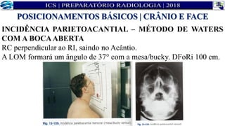 INCIDÊNCIA PARIETOACANTIAL – MÉTODO DE WATERS
COM A BOCAABERTA
RC perpendicular ao RI, saindo no Acântio.
A LOM formará um ângulo de 37° com a mesa/bucky. DFoRi 100 cm.
POSICIONAMENTOS BÁSICOS | CRÂNIO E FACE
 