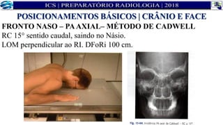 FRONTO NASO – PAAXIAL– MÉTODO DE CADWELL
RC 15° sentido caudal, saindo no Násio.
LOM perpendicular ao RI. DFoRi 100 cm.
POSICIONAMENTOS BÁSICOS | CRÂNIO E FACE
 