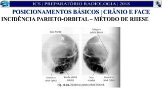 INCIDÊNCIA PARIETO-ORBITAL – MÉTODO DE RHESE
POSICIONAMENTOS BÁSICOS | CRÂNIO E FACE
 
