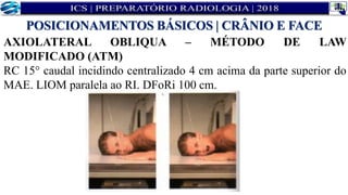 AXIOLATERAL OBLIQUA – MÉTODO DE LAW
MODIFICADO (ATM)
RC 15° caudal incidindo centralizado 4 cm acima da parte superior do
MAE. LIOM paralela ao RI. DFoRi 100 cm.
POSICIONAMENTOS BÁSICOS | CRÂNIO E FACE
 