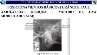 AXIOLATERAL OBLIQUA – MÉTODO DE LAW
MODIFICADO (ATM)
POSICIONAMENTOS BÁSICOS | CRÂNIO E FACE
 