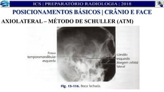 AXIOLATERAL – MÉTODO DE SCHULLER (ATM)
POSICIONAMENTOS BÁSICOS | CRÂNIO E FACE
 