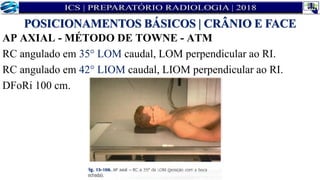 AP AXIAL - MÉTODO DE TOWNE - ATM
RC angulado em 35° LOM caudal, LOM perpendicular ao RI.
RC angulado em 42° LIOM caudal, LIOM perpendicular ao RI.
DFoRi 100 cm.
POSICIONAMENTOS BÁSICOS | CRÂNIO E FACE
 