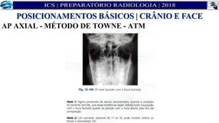 AP AXIAL - MÉTODO DE TOWNE - ATM
POSICIONAMENTOS BÁSICOS | CRÂNIO E FACE
 