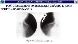 PERFIL – OSSOS NASAIS
POSICIONAMENTOS BÁSICOS | CRÂNIO E FACE
 