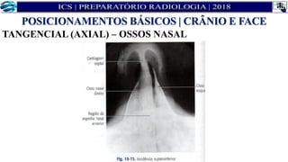 TANGENCIAL (AXIAL) – OSSOS NASAL
POSICIONAMENTOS BÁSICOS | CRÂNIO E FACE
 