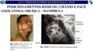 AXIOLATERAL OBLÍQUA – MANDÍBULA
POSICIONAMENTOS BÁSICOS | CRÂNIO E FACE
 