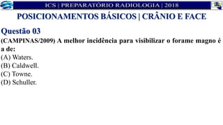 Questão 03
(CAMPINAS/2009) A melhor incidência para visibilizar o forame magno é
a de:
(A) Waters.
(B) Caldwell.
(C) Towne.
(D) Schuller.
POSICIONAMENTOS BÁSICOS | CRÂNIO E FACE
 