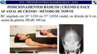 AP AXIAL DE CRÂNIO - MÉTODO DE TOWNE
RC angulado em 30° LOM ou 37° LIOM caudal, na direção de 6 cm
acima da glabela. DFoRi 100 cm.
POSICIONAMENTOS BÁSICOS | CRÂNIO E FACE
 