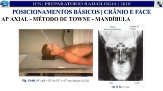 AP AXIAL - MÉTODO DE TOWNE - MANDÍBULA
POSICIONAMENTOS BÁSICOS | CRÂNIO E FACE
 