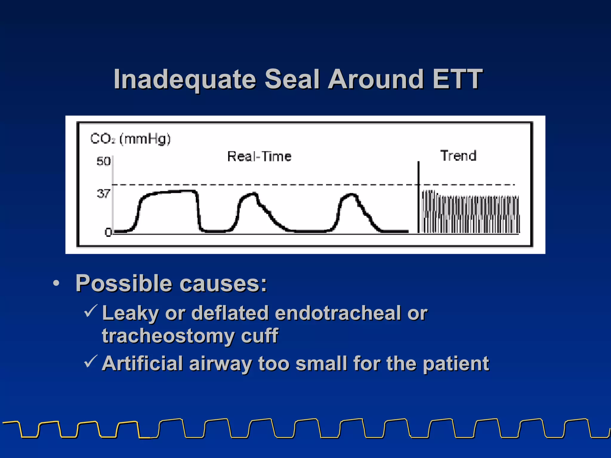 Inadequate Seal Around ETT Possible causes: Leaky or deflated endotracheal or tracheostomy cuff Artificial airway too small for the patient 