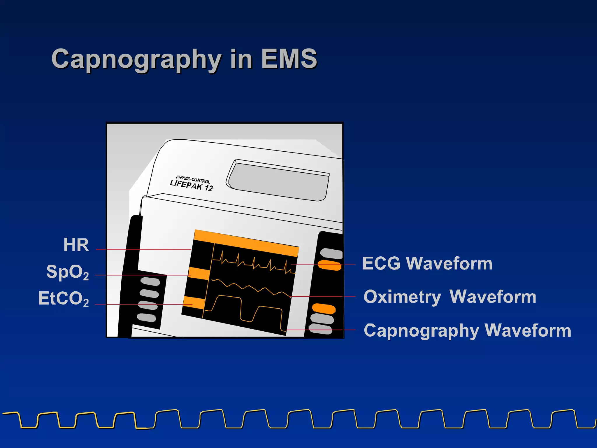 Capnography in EMS 