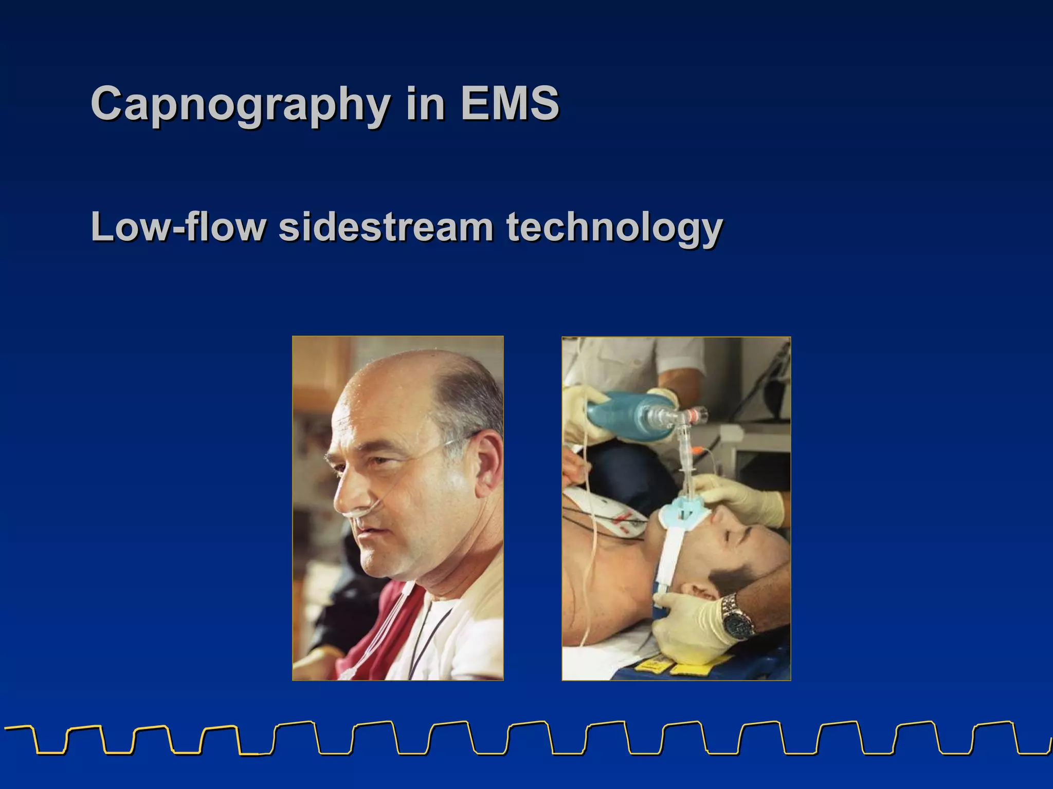 Capnography in EMS Low-flow sidestream technology 