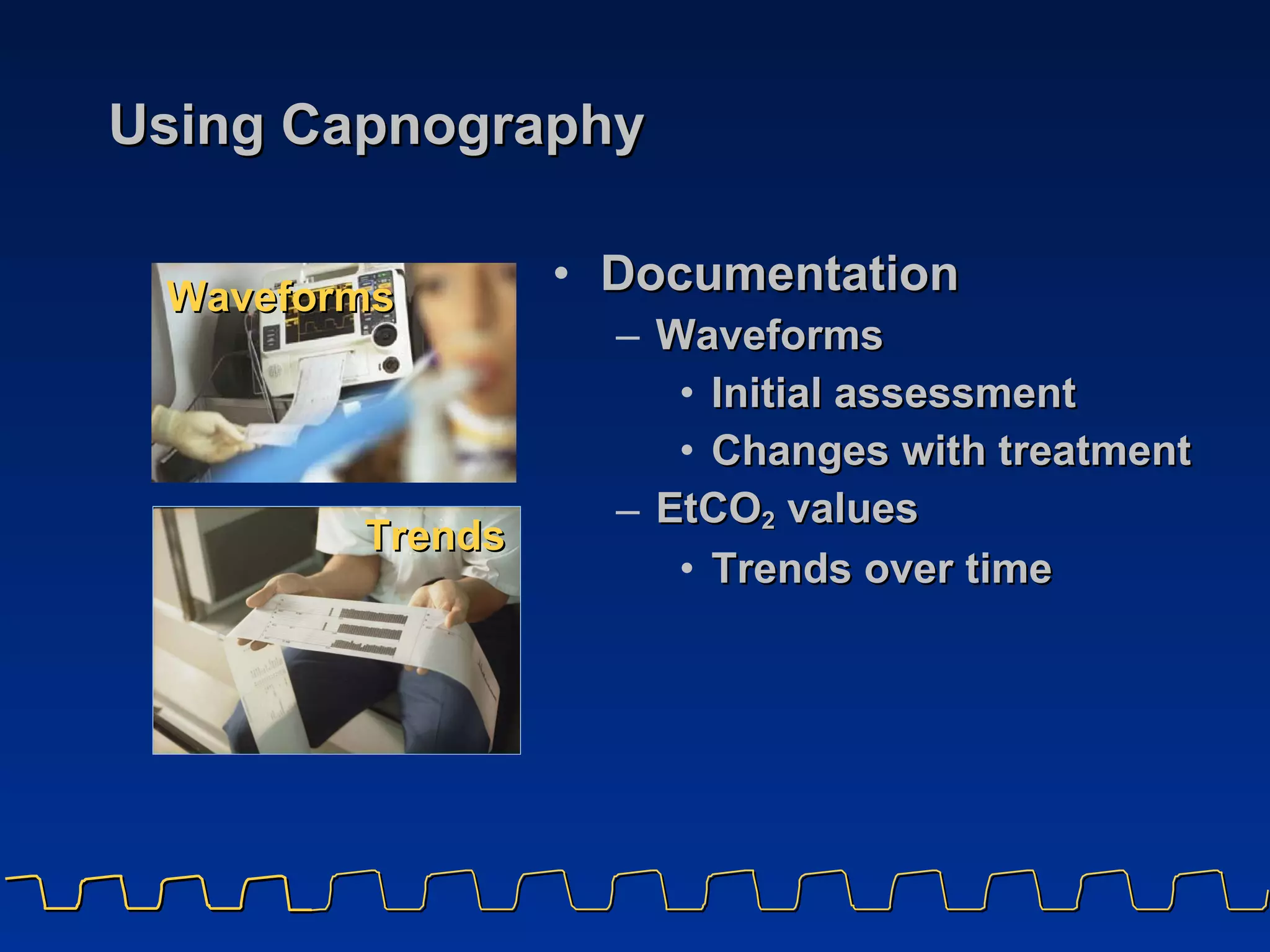 Using Capnography Documentation Waveforms Initial assessment Changes with treatment EtCO 2  values Trends over time Waveforms Trends 