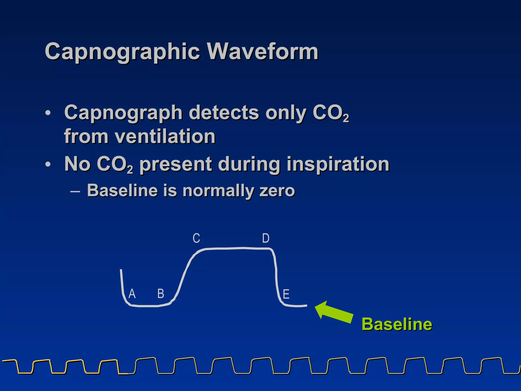 Capnographic Waveform Capnograph detects only CO 2   from ventilation No CO 2  present during inspiration Baseline is normally zero Baseline 