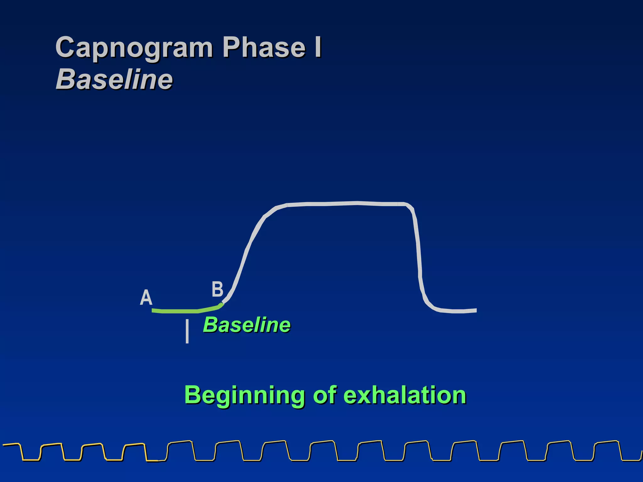 Capnogram Phase I  Baseline Beginning of exhalation A B I Baseline 