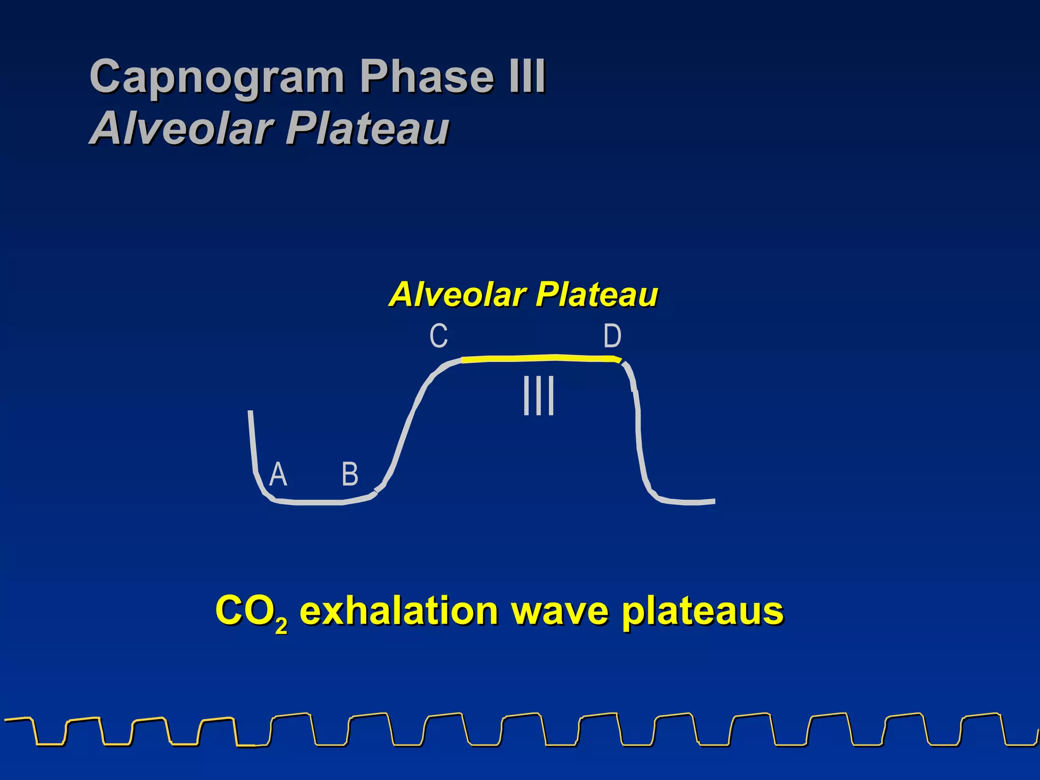 Capnogram Phase III Alveolar Plateau CO 2  exhalation wave plateaus Alveolar Plateau A B C D I I I 