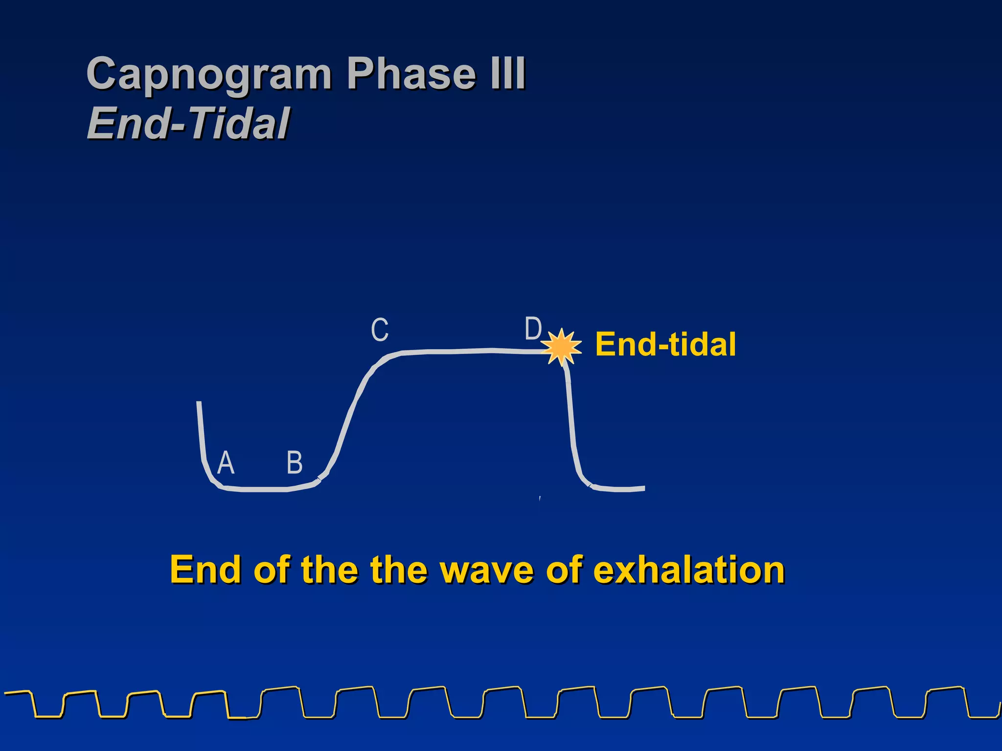 Capnogram Phase III End-Tidal End of the the wave of exhalation A B C D End-tidal 