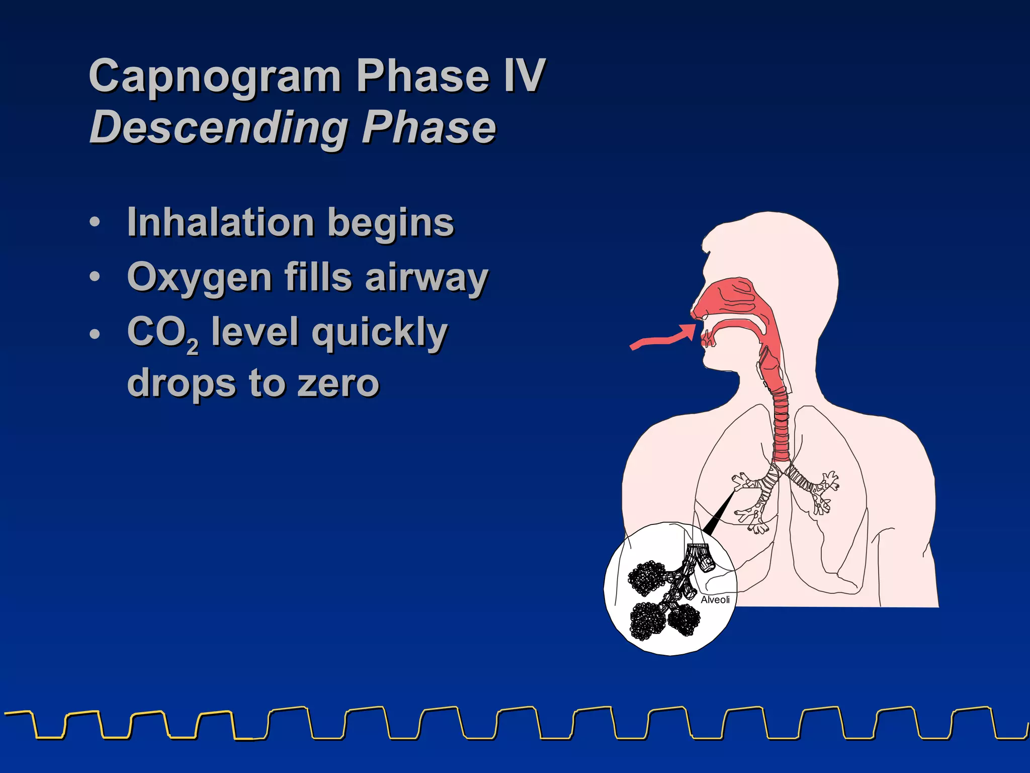 Capnogram Phase IV Descending Phase Inhalation begins Oxygen fills airway CO 2  level quickly  drops to zero 