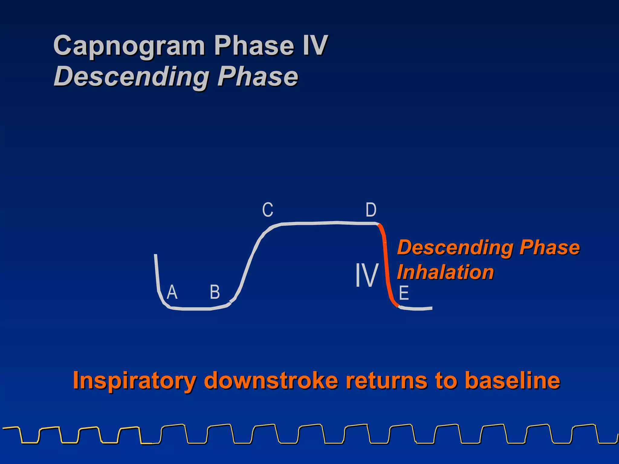 Capnogram Phase IV Descending Phase Inspiratory downstroke returns to baseline A B C D E I V Descending Phase  Inhalation 