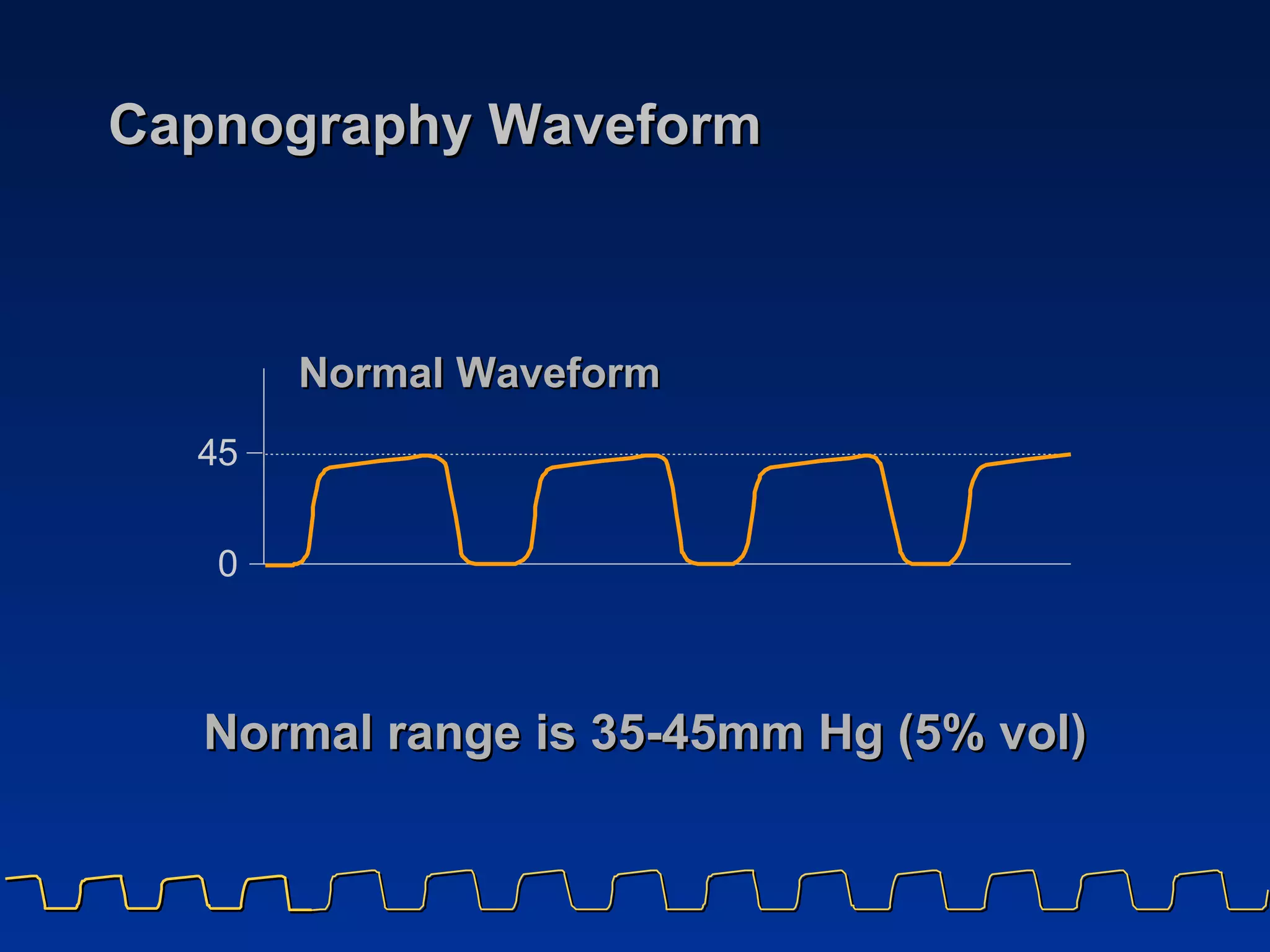 Capnography Waveform Normal range is 35-45mm Hg (5% vol) Normal Waveform 