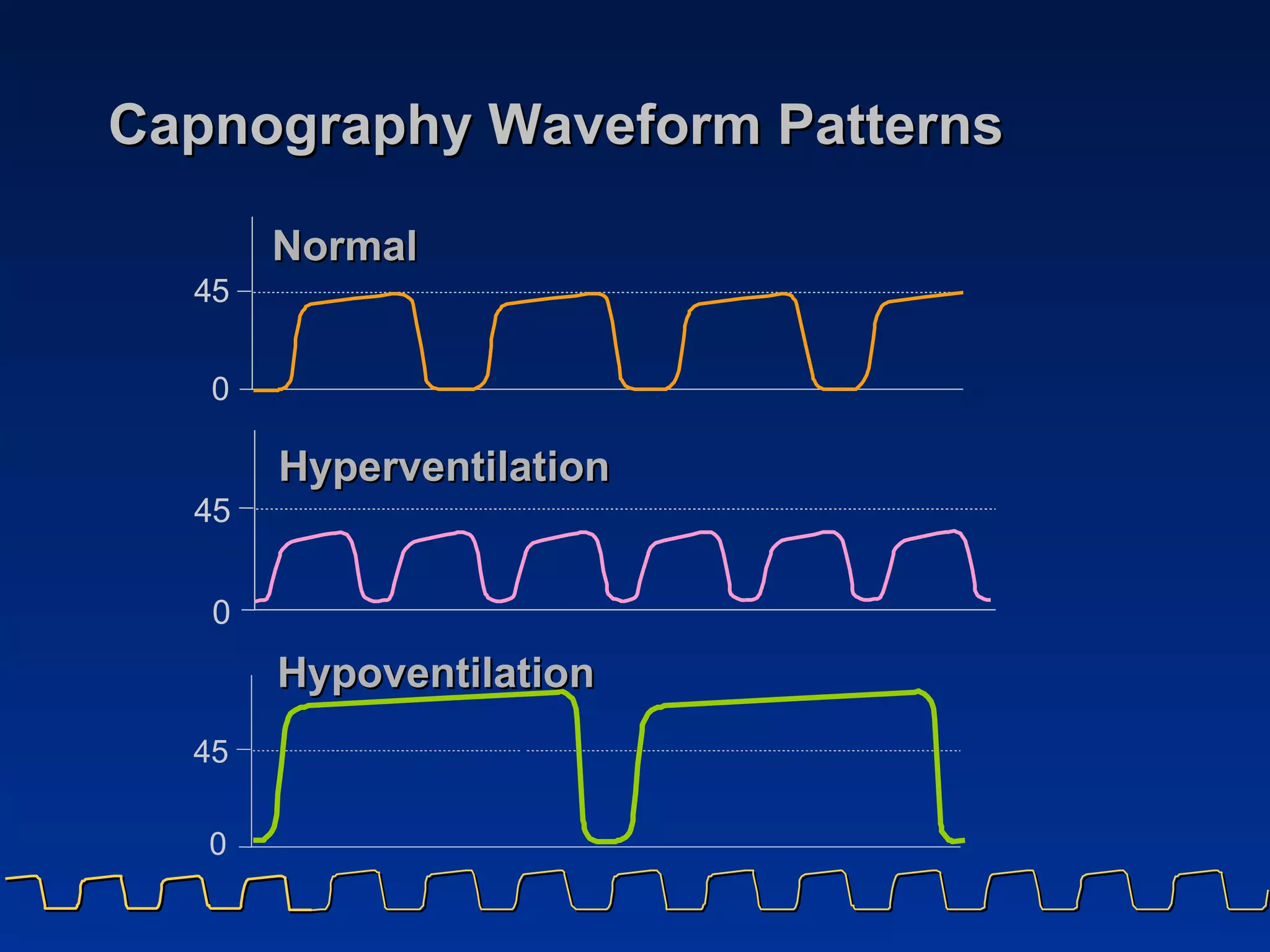Capnography Waveform Patterns 0 4 5 Hypoventilation 4 5 0 Hyperventilation Normal 