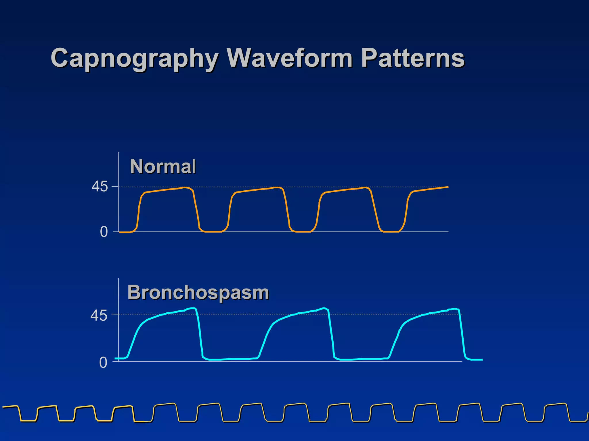 Capnography Waveform Patterns  Norma l Bronchospasm 4 5 0 