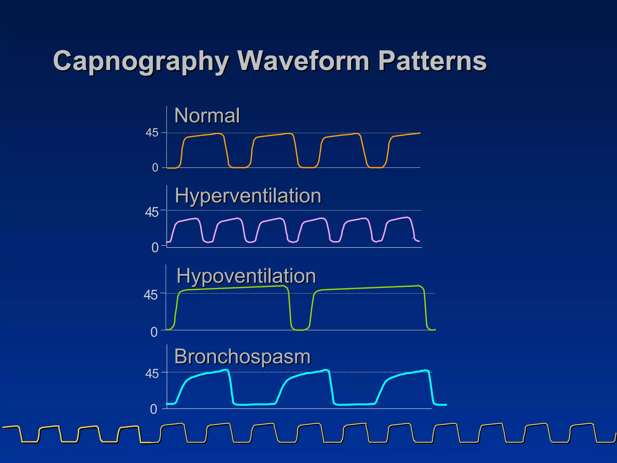 Capnography Waveform Patterns Hypoventilation Normal Bronchospasm Hyperventilation 4 5 0 4 5 0 4 5 0 
