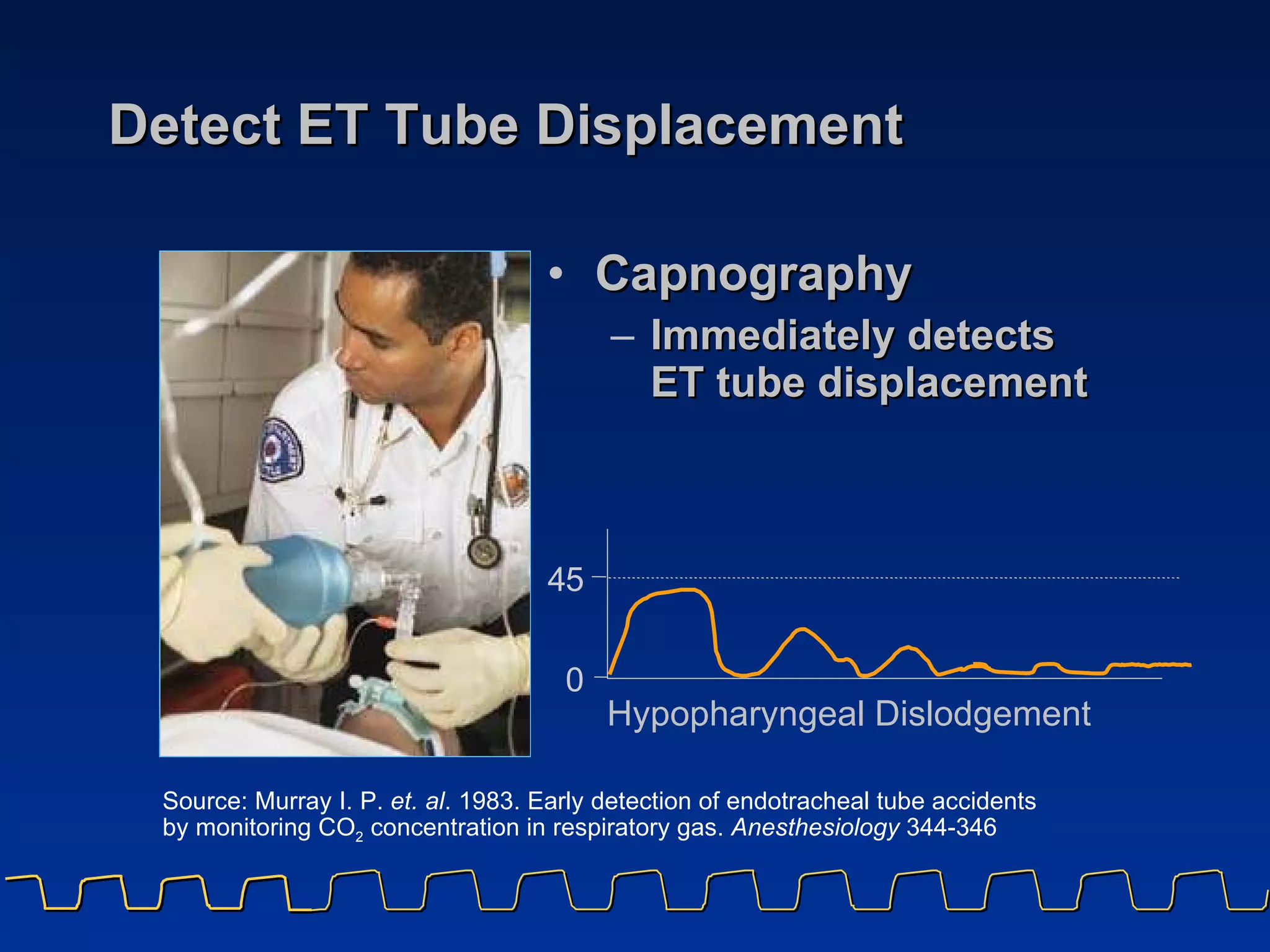 Detect ET Tube Displacement Capnography Immediately detects  ET tube displacement Source: Murray I. P.  et. al . 1983. Early detection of endotracheal tube accidents by monitoring CO 2  concentration in respiratory gas.  Anesthesiology  344-346  4 5 0 Hypopharyngeal Dislodgement 