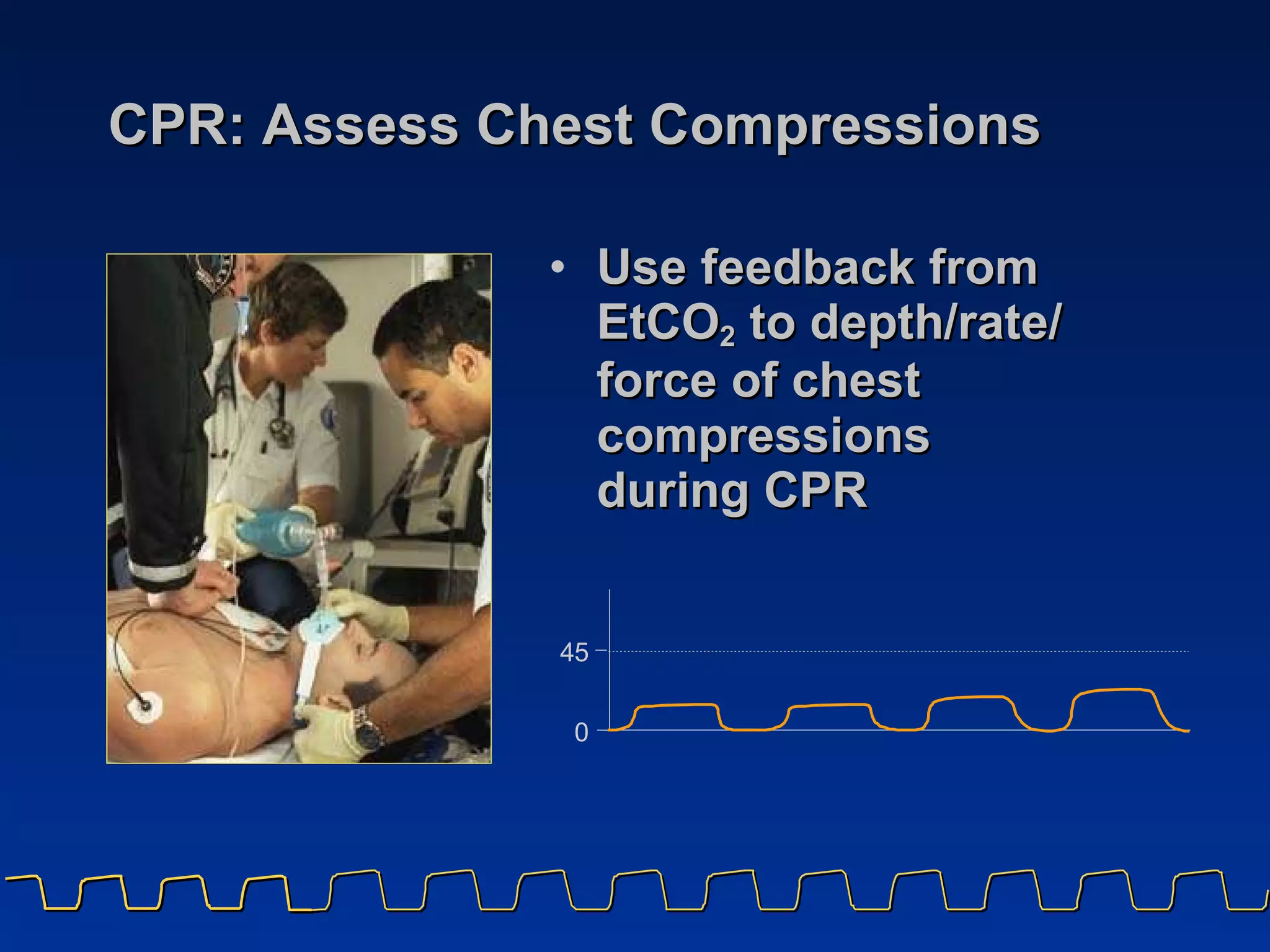 CPR: Assess Chest Compressions Use feedback from EtCO 2  to depth/rate/ force of chest compressions  during CPR 4 5 0 