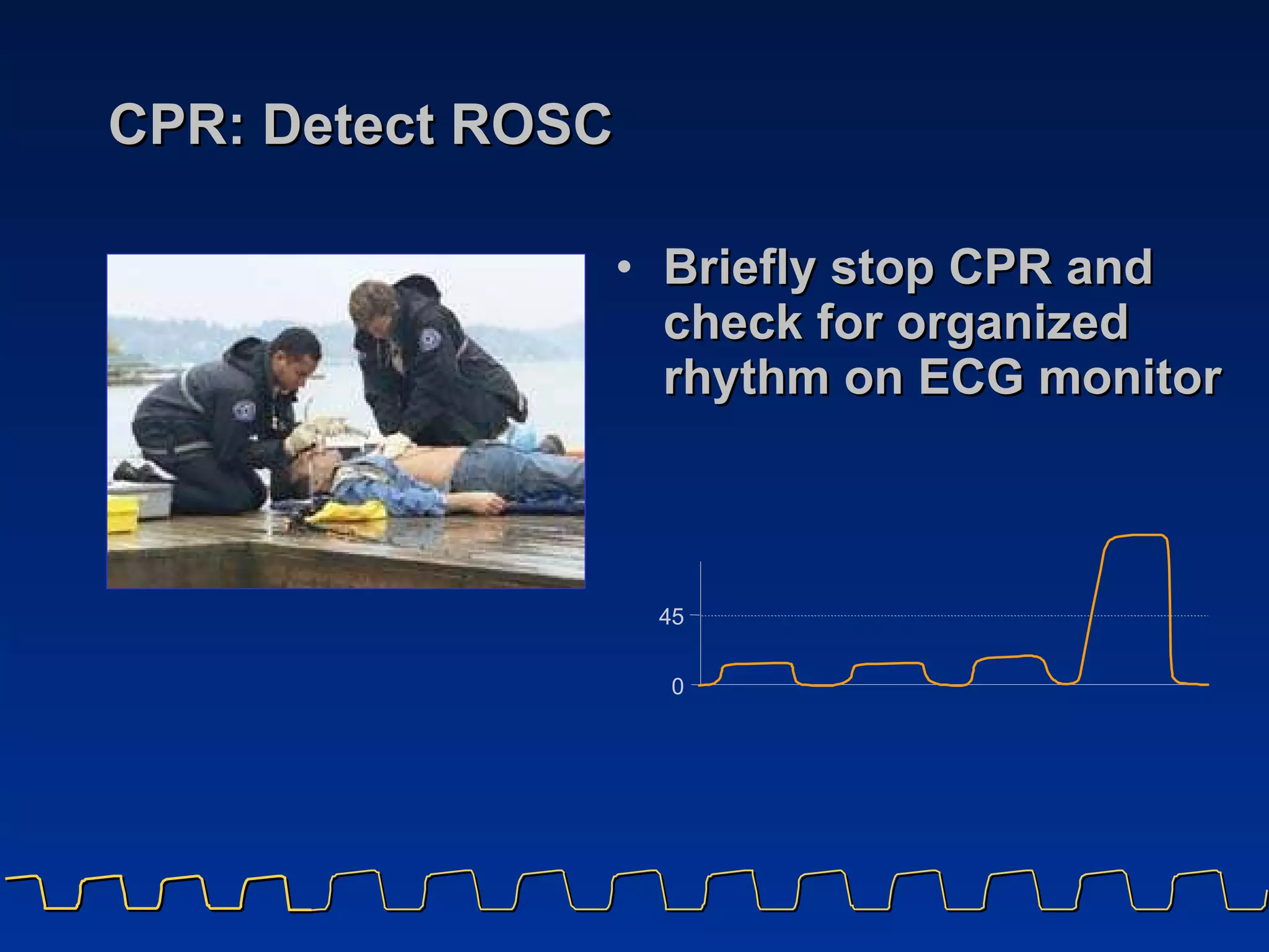 CPR: Detect ROSC Briefly stop CPR and check for organized rhythm on ECG monitor 4 5 0 