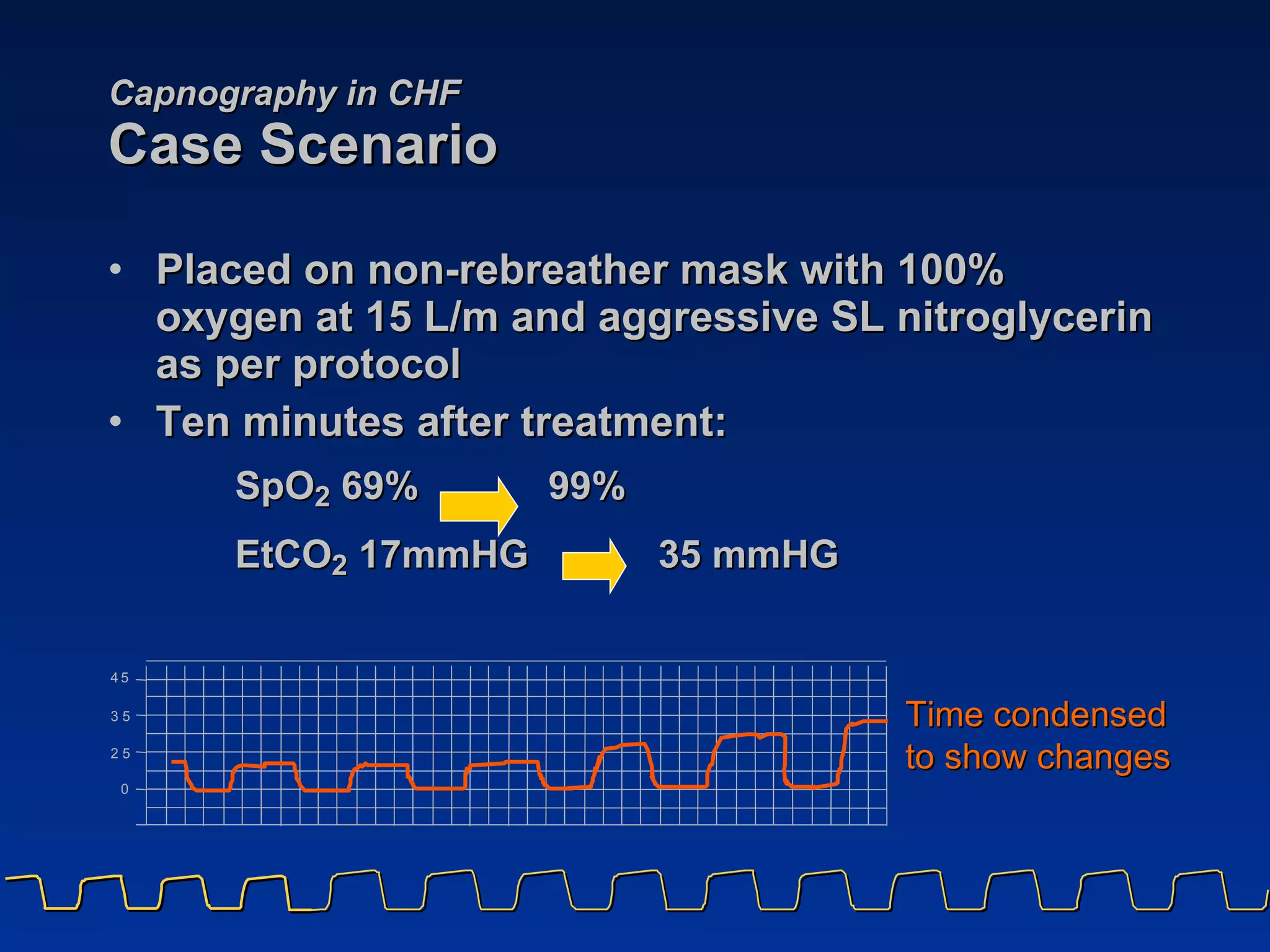 Capnography in CHF Case Scenario Placed on non-rebreather mask with 100% oxygen at 15 L/m and aggressive SL nitroglycerin as per protocol Ten minutes after treatment: SpO 2  69%  99% EtCO 2  17mmHG  35 mmHG   Time condensed  to show changes 4 5 3 5 0 2 5 