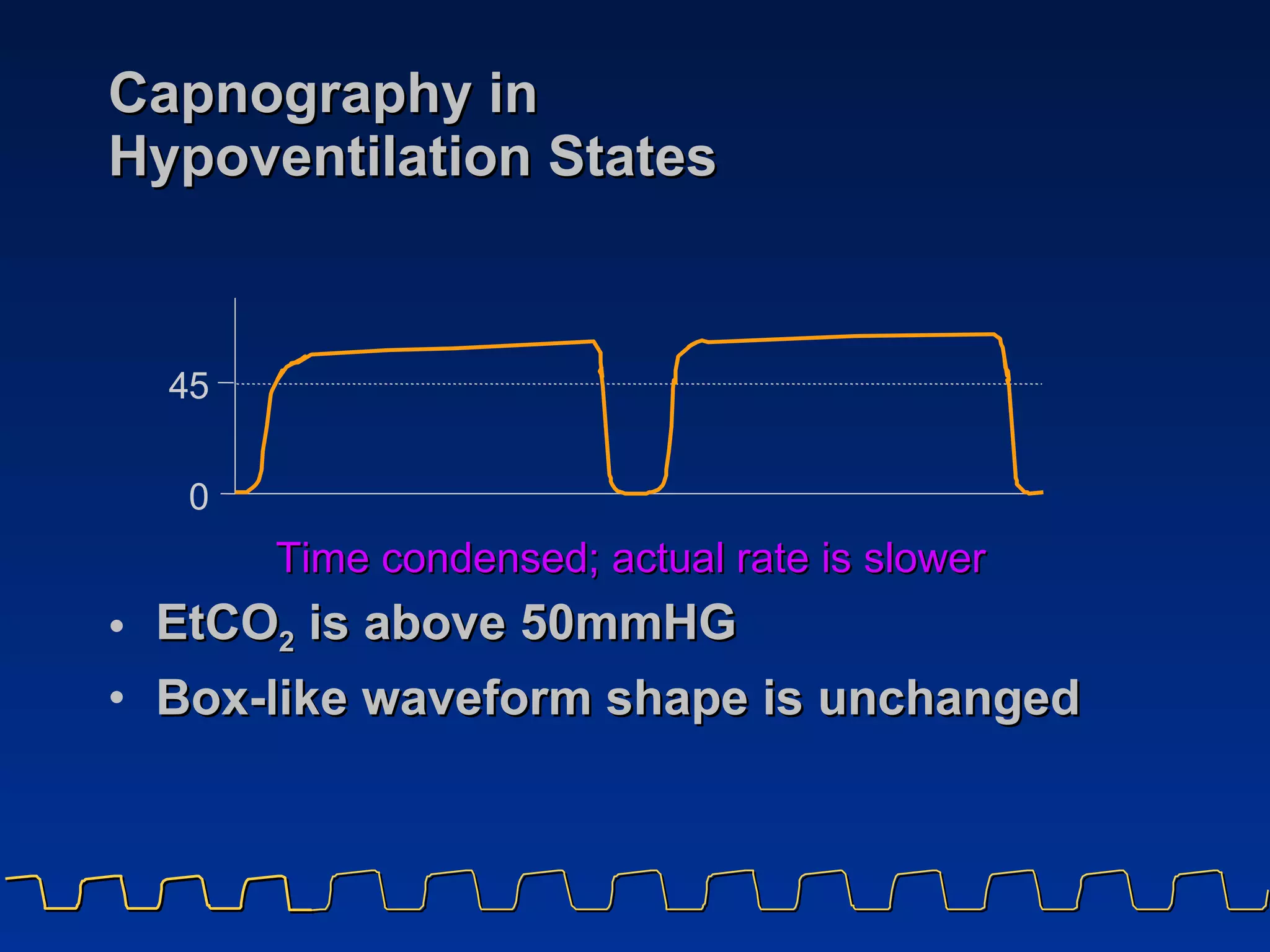 Capnography in  Hypoventilation States EtCO 2  is above 50mmHG Box-like waveform shape is unchanged Time condensed; actual rate is slower   4 5 0 