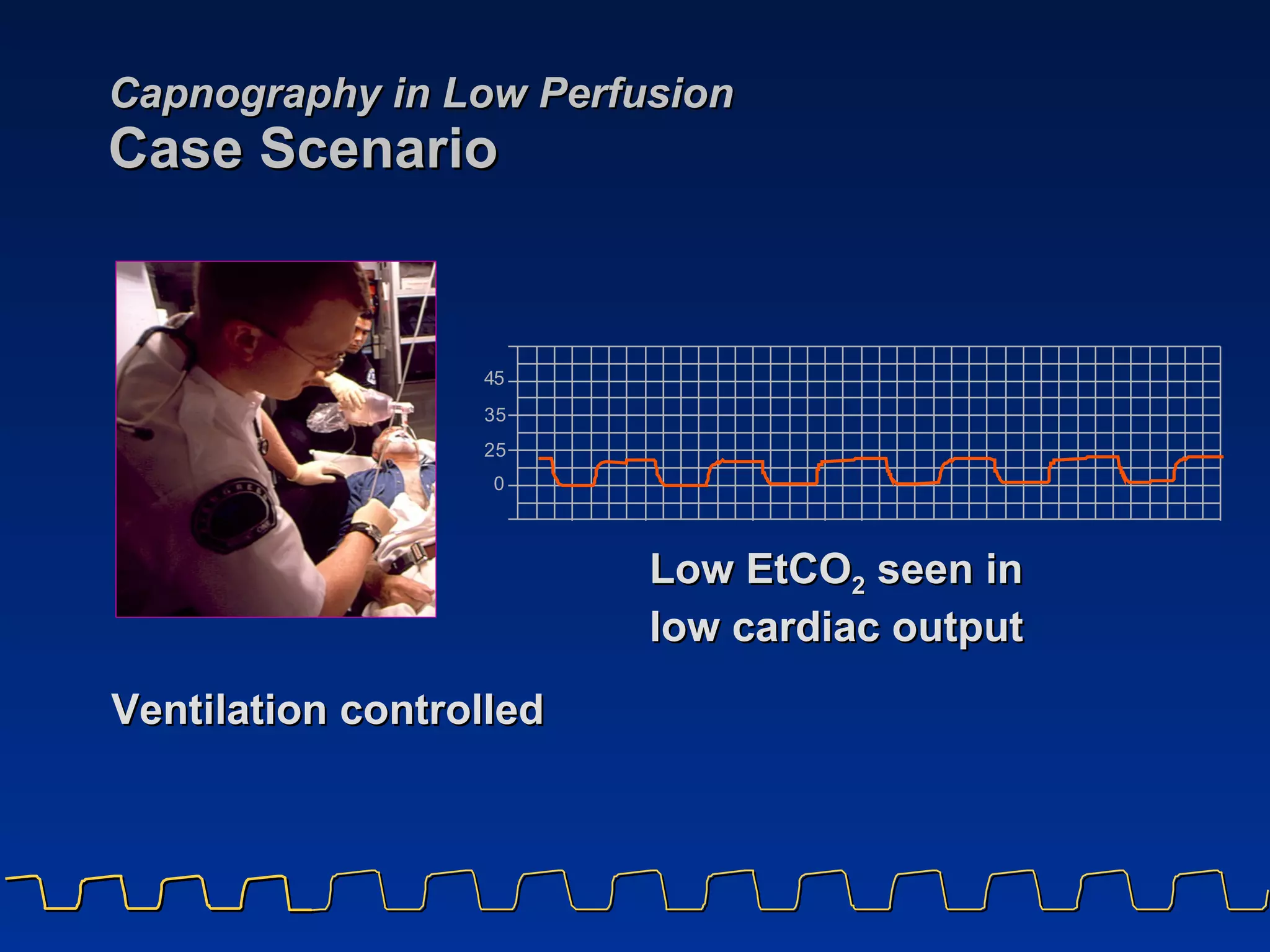 Capnography in Low Perfusion Case Scenario Low EtCO 2  seen in  low cardiac output Ventilation controlled 