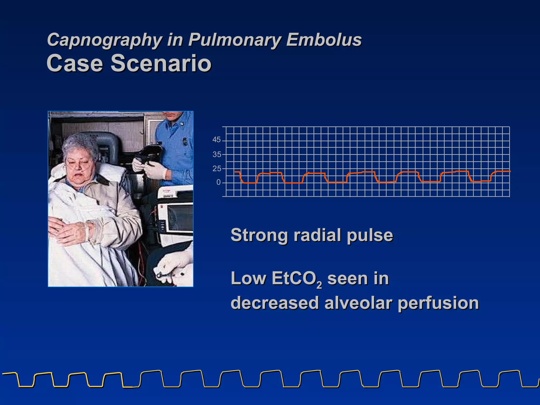 Capnography in Pulmonary Embolus Case Scenario Strong radial pulse Low EtCO 2  seen in  decreased alveolar perfusion 
