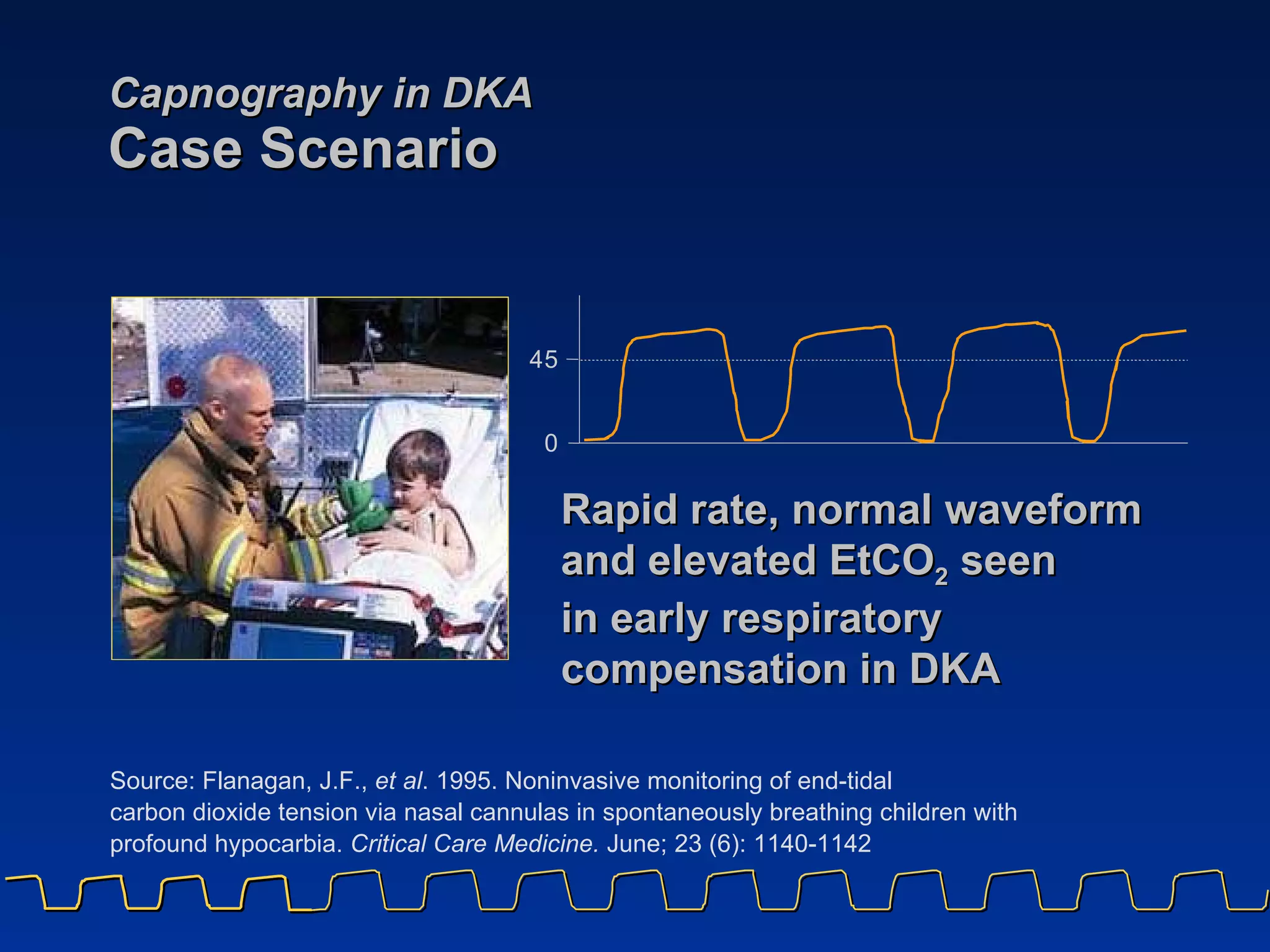 Capnography in DKA Case Scenario Rapid rate, normal waveform and elevated EtCO 2  seen  in early respiratory compensation in DKA Source: Flanagan, J.F.,  et al . 1995. Noninvasive monitoring of end-tidal  carbon dioxide tension via nasal cannulas in spontaneously breathing children with  profound hypocarbia.  Critical Care Medicine.  June; 23 (6): 1140-1142 4 5 0 