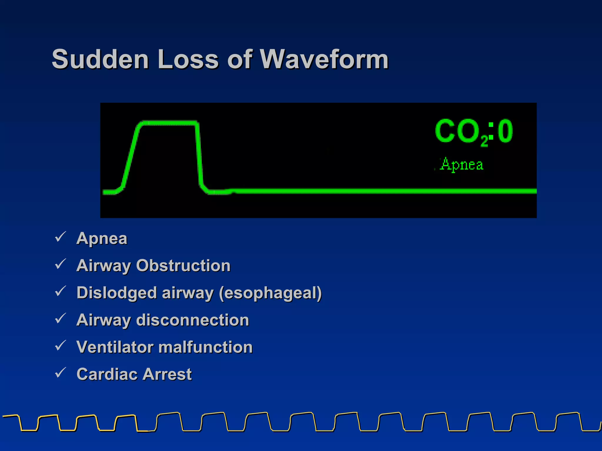 Sudden Loss of Waveform Apnea Airway Obstruction Dislodged airway (esophageal) Airway disconnection Ventilator malfunction Cardiac Arrest 