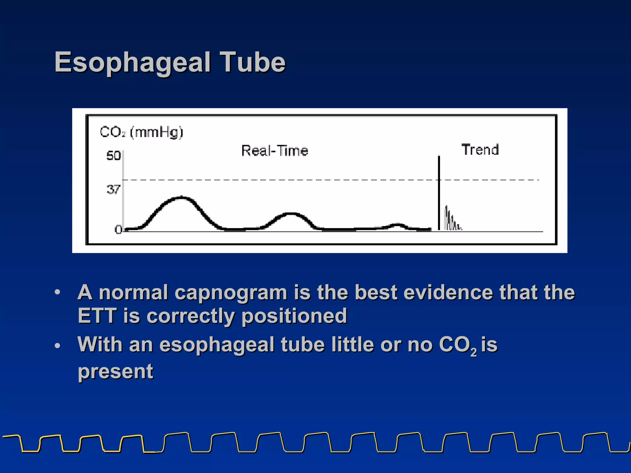 Esophageal Tube A normal capnogram is the best evidence that the ETT is correctly positioned With an esophageal tube little or no CO 2  is present 