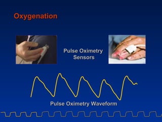 Oxygenation Pulse Oximetry Sensors Pulse Oximetry Waveform 