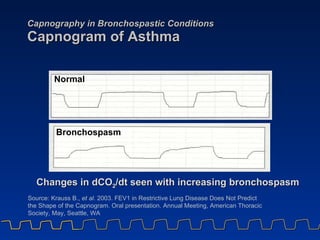 Capnography in Bronchospastic Conditions Capnogram of Asthma Source: Krauss B.,  et al . 2003. FEV1 in Restrictive Lung Di...