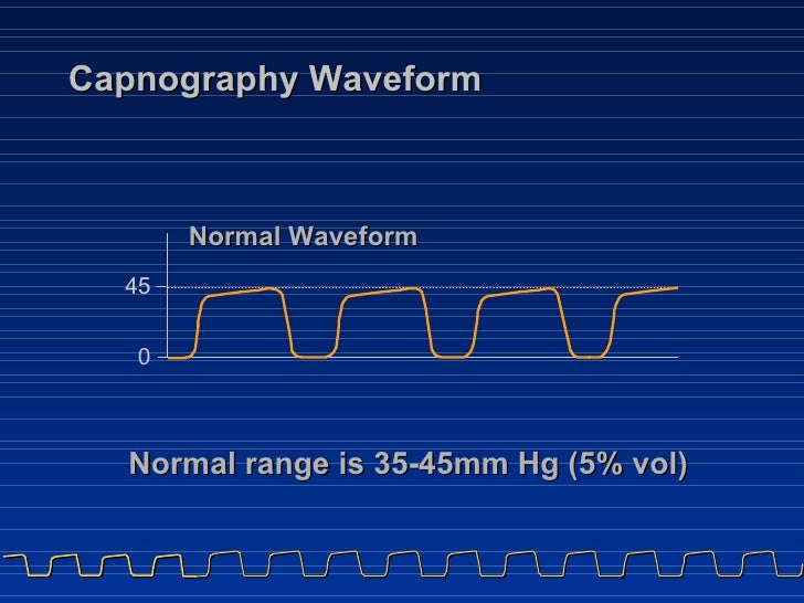 Capnography range - socalvir