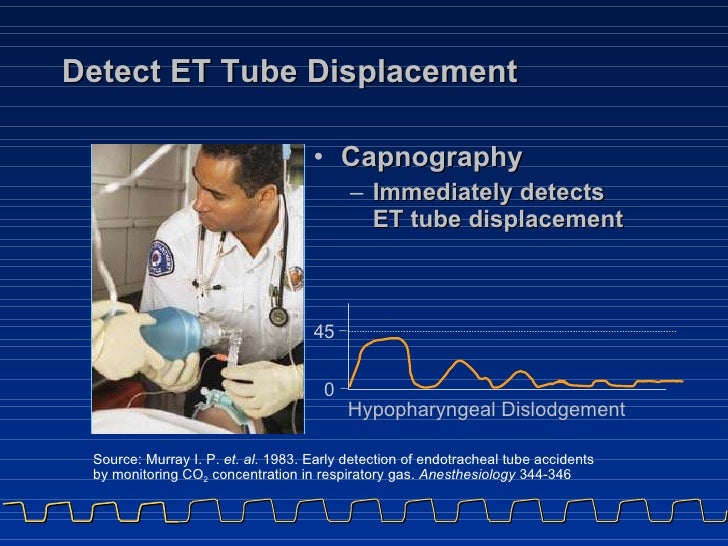03 capnography
