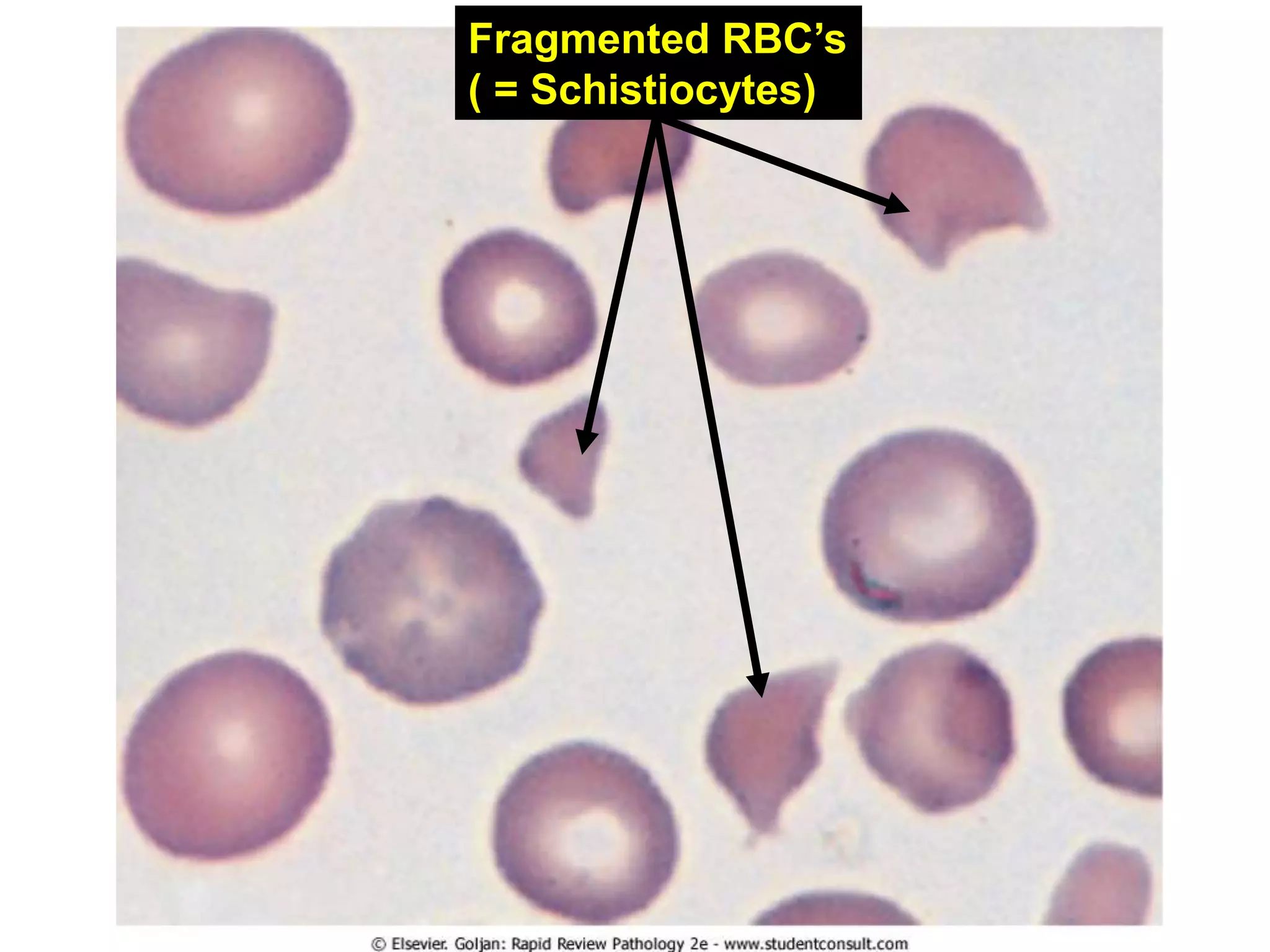 03 cardiac pathology | PPT
