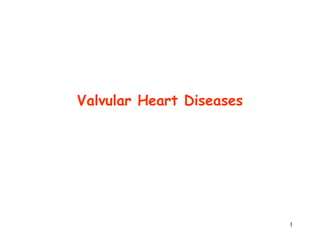 1
Valvular Heart Diseases
 